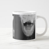 X-rayed 3 grote koffiekop (Rechts)