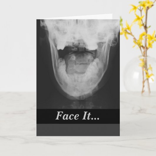 X-rayed 3 kaart (Gele Bloem)