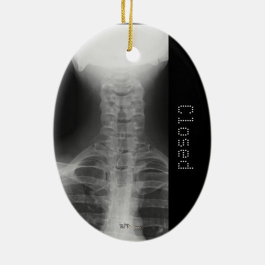 X-rayed 3 keramisch ornament (Achterkant)