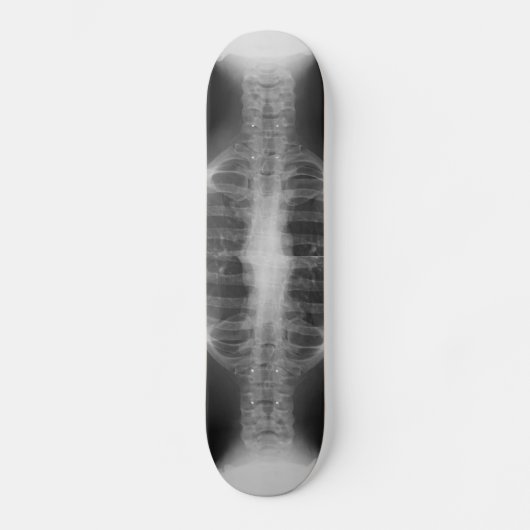 X-rayed 3 persoonlijk skateboard (Voorkant)