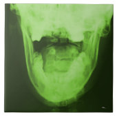 X-rayed 3 - Radioactive Green Tegeltje (Voorkant)