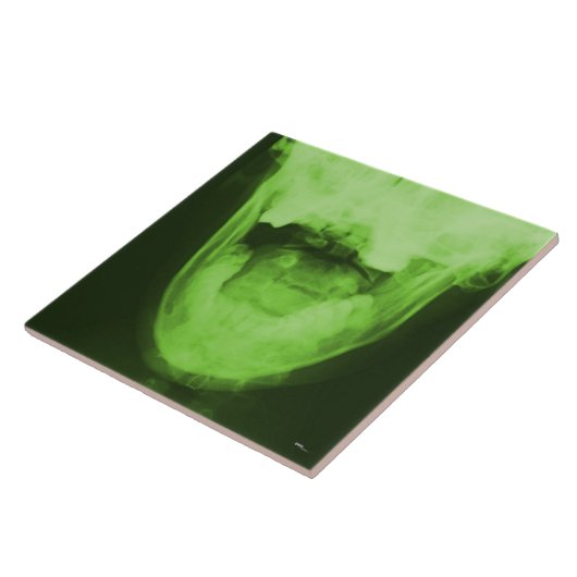 X-rayed 3 - Radioactive Green Tegeltje (Zijkant)