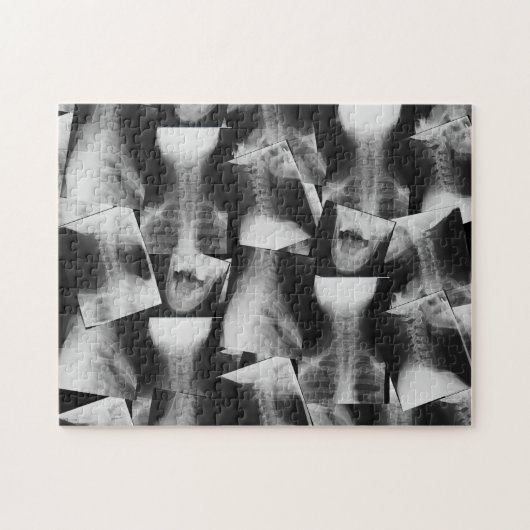 X-Rayed (origineel) Legpuzzel (Horizontaal)