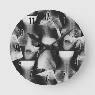 X-rayed Ronde Klok