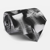 X-rayed Stropdas (Opgerold)