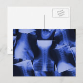 X-straling - elektromagnetisch blauw briefkaart (Voorkant / Achterkant)