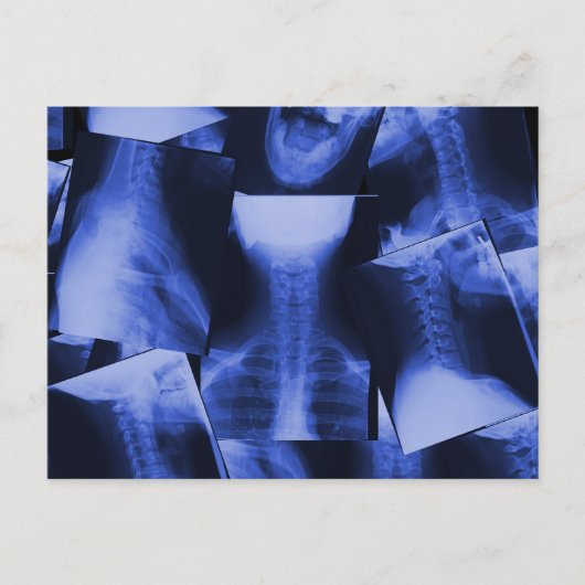X-straling - elektromagnetisch blauw briefkaart (Voorkant)