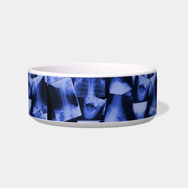 X-straling - elektromagnetisch blauw voerbakje (Rechts)