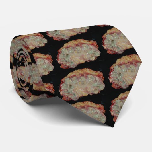 Xanthogranulomateuze pyelonefritis stropdas (Opgerold)