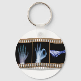 XRAY SIGN TAAL FILM - HAND OK HANDSHAKE SLEUTELHANGER
