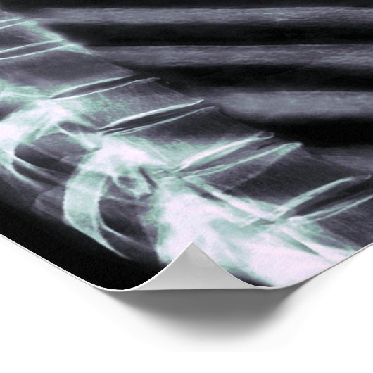 XRAY SKELETON DRILL ORIGINAL COLORS POSTER (Hoek)