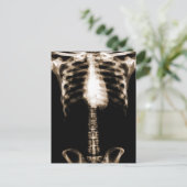 XRAY SKELETON TORSO RIBS SEPIA BRIEFKAART (Staand voorkant)