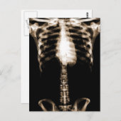 XRAY SKELETON TORSO RIBS SEPIA BRIEFKAART (Voorkant / Achterkant)