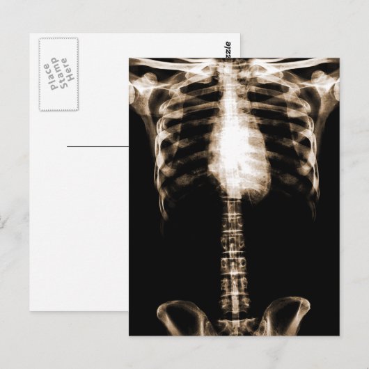 XRAY SKELETON TORSO RIBS SEPIA BRIEFKAART (Voorkant / Achterkant)