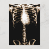 XRAY SKELETON TORSO RIBS SEPIA