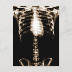 XRAY SKELETON TORSO RIBS SEPIA BRIEFKAART