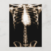 XRAY SKELETON TORSO RIBS SEPIA BRIEFKAART (Voorkant)