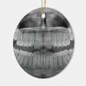 Xray Smile Keramisch Ornament (Links)