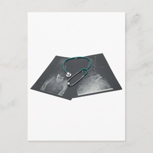 XRayConsult061209 Briefkaart (Voorkant)