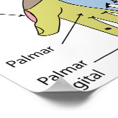 Zenuwstelsel Huiduitslag Recht Limiet Poster (Hoek)