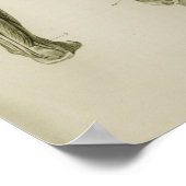 Zenuwstelselaandoeningen anatomische voorzijde poster (Hoek)