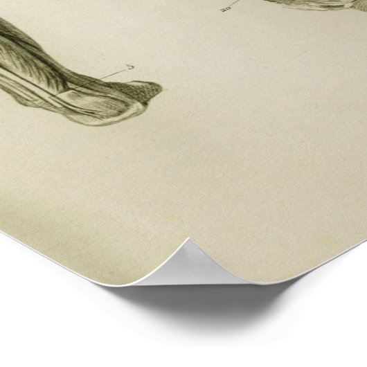 Zenuwstelselaandoeningen  anatomische voorzijde poster (Hoek)