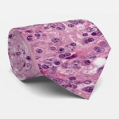 Ziekte van Rosai-Dorfman Stropdas (Opgerold)