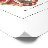 Ziekten van Larynx Anatomy Poster French (Hoek)