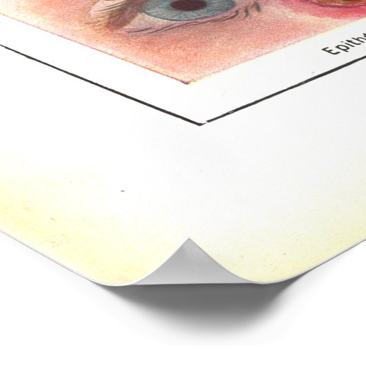 Ziekten van Oog-anatomie Poster Frans (Hoek)