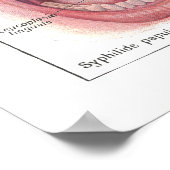 Ziekten van Poster van de anatomie in de mond (Hoek)