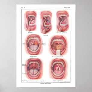Ziekten van Poster van de anatomie in de mond