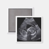 Zwanger Sonogram Foto Tijdloos Keepsake plezier Magneet (Voorkant / Achterkant)