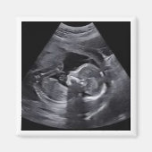 Zwanger Sonogram Foto Tijdloos Keepsake plezier Magneet (Voorkant)