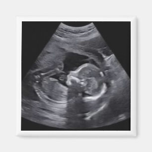 Zwanger Sonogram Foto Tijdloos Keepsake plezier Magneet