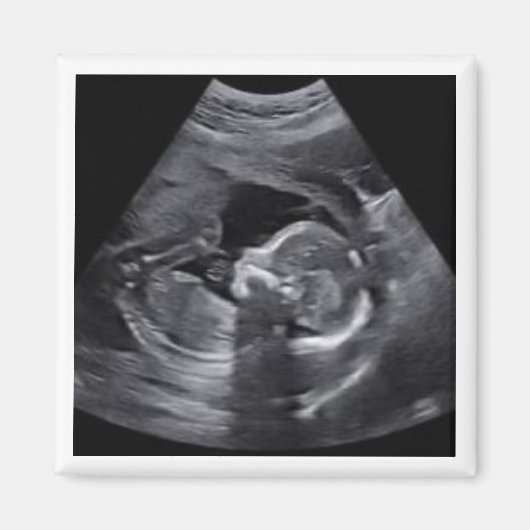 Zwanger Sonogram Foto Tijdloos Keepsake plezier Magneet (Voorkant)