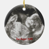 Zwangere kerstversiering - Reindeer Ultrasound Keramisch Ornament (Achterkant)