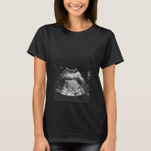 ZWANGERE TURKIJE ULTRASOUND T-SHIRT