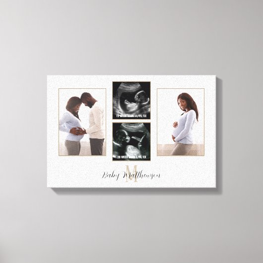 Zwangerschap 4 foto Collage Monogram Eerste Letter Canvas Afdruk (Voorkant)