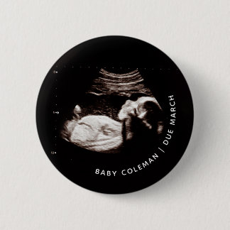 Zwangerschap Aankondiging Baby Sonogram Foto Ronde Button 5,7 Cm
