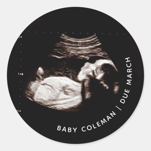 Zwangerschap Aankondiging Baby Sonogram Foto Ronde Sticker (Voorkant)