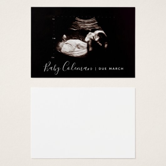 Zwangerschap Aankondiging Sonogram Mini Card (Voorkant /achterkant)