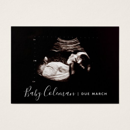 Zwangerschap Aankondiging Sonogram Mini Card (Voorkant)