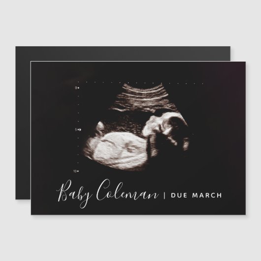 Zwangerschap Aankondiging Sonogram Naam Magnet (Voorkant / Achterkant)