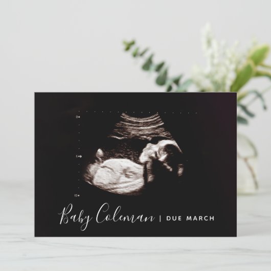 Zwangerschap Aankondiging Sonogram Script Name Car (Staand voorkant)