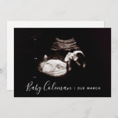 Zwangerschap Aankondiging Sonogram Script Name Car (Voorkant / Achterkant)