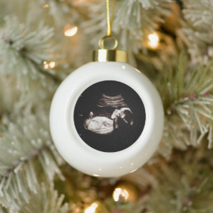 Zwangerschap Aankondiging Sonogram Ultrasound Foto Keramische Bal Ornament
