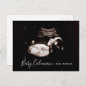 Zwangerschap Aankondiging Sonogram Verwacht Briefk (Voorkant / Achterkant)