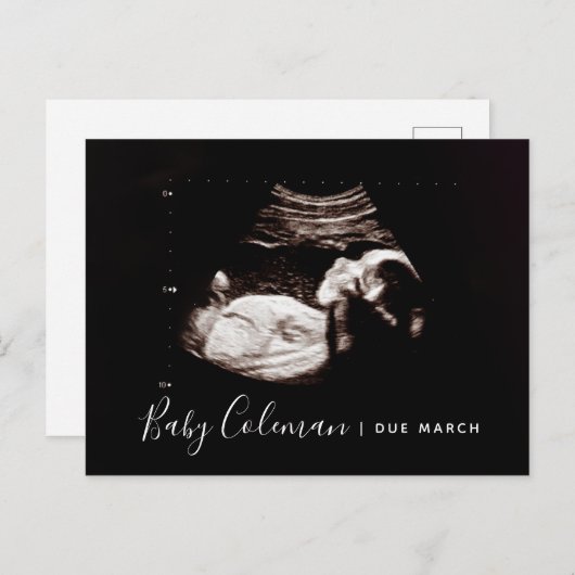 Zwangerschap Aankondiging Sonogram Verwacht Briefk (Voorkant / Achterkant)
