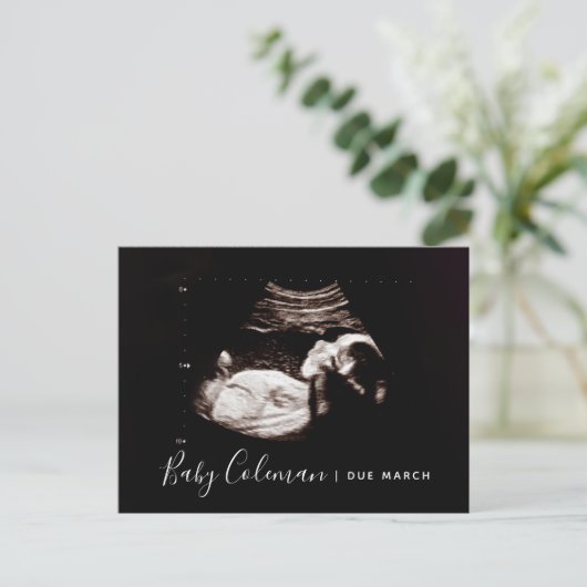 Zwangerschap Aankondiging Sonogram Verwacht Briefk (Staand voorkant)