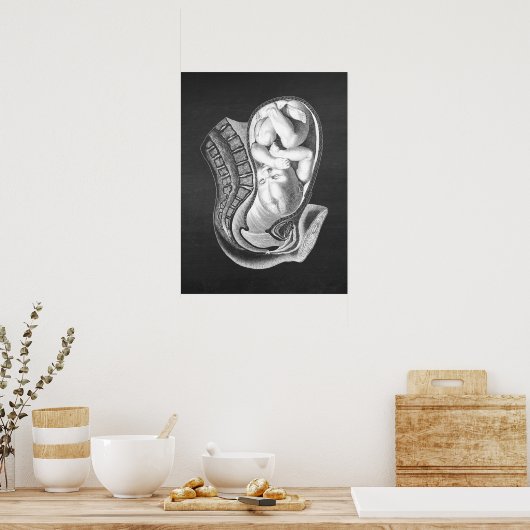 Zwangerschap baarmoeder Anatomie Obstetrisch Decor Poster (Keuken)